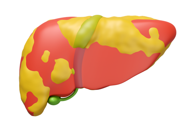 Fatty Liver  3D Icon