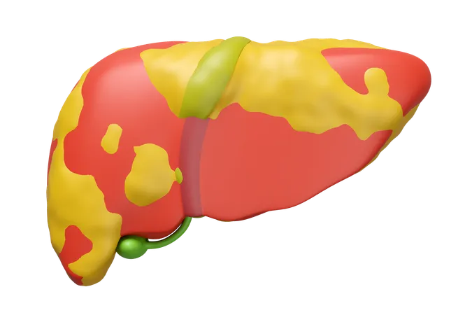 Fatty Liver  3D Icon