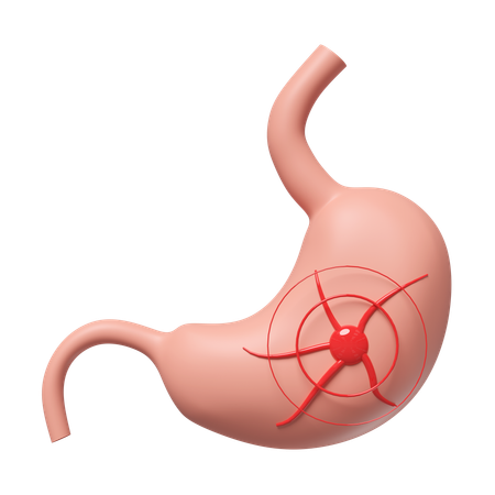 Gastric Disease  3D Icon