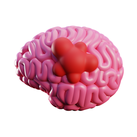 Großer Hirntumor  3D Icon