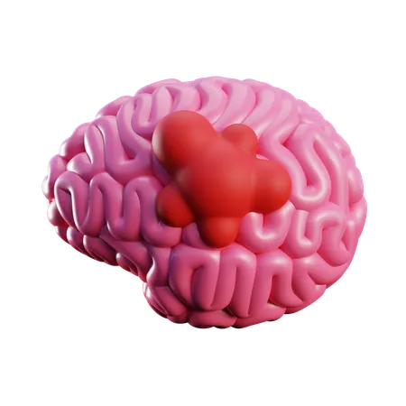 Großer Hirntumor  3D Icon