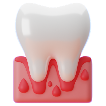 Gum Disease  3D Icon