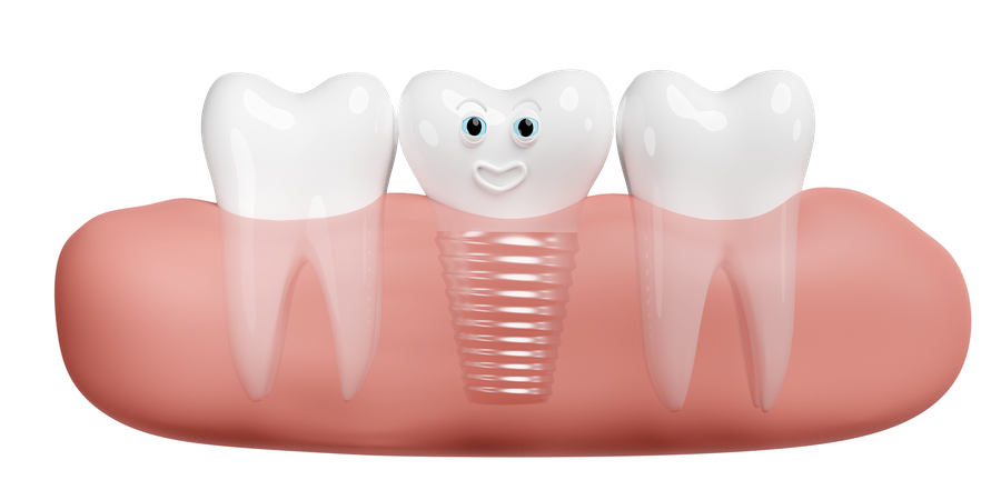 Gum with dental implant  3D Icon
