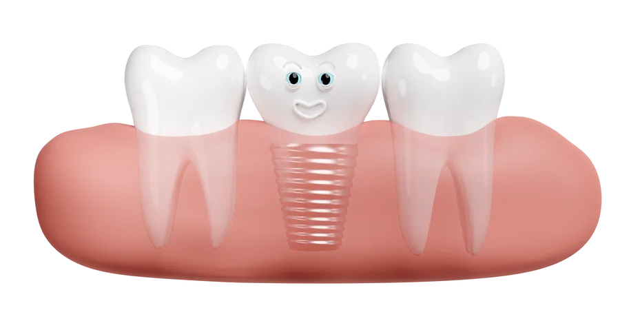 Gum with dental implant  3D Illustration