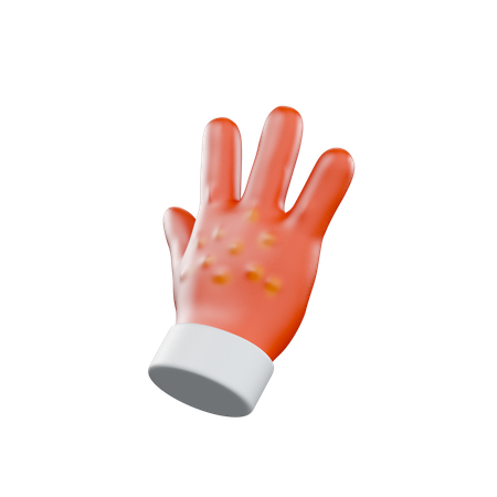 Hand Allergy  3D Illustration