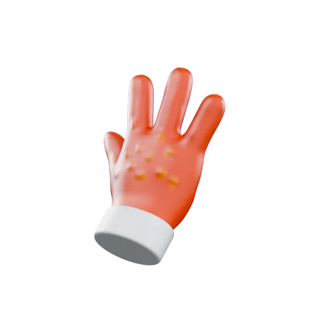 Hand Allergy  3D Illustration