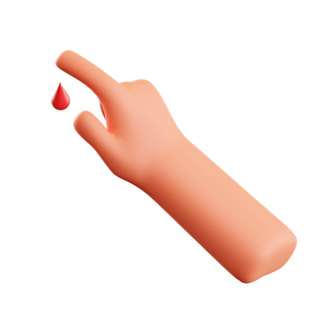 Hand Injury 3D Illustration