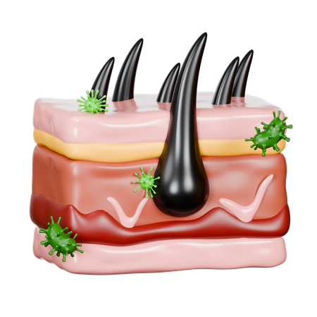 Haut mit Haarfollikelerkrankungen  3D Icon