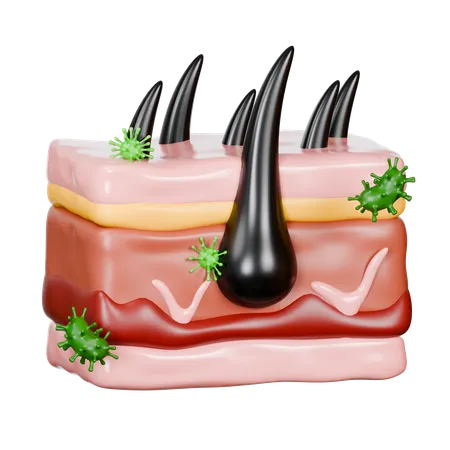 Haut mit Haarfollikelerkrankungen  3D Icon