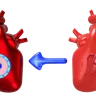 Heart Transplantation