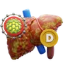 Hepatitis D