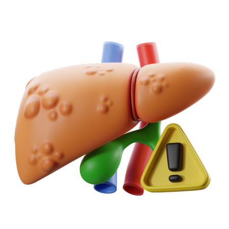 Hepatitis, Lebererkrankung mit Warnsymbol  3D Icon