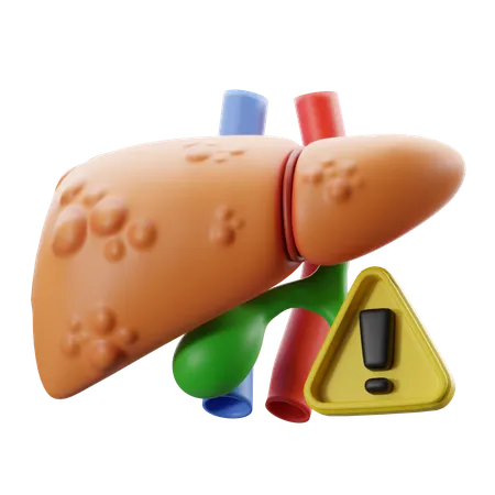 Hepatitis, Lebererkrankung mit Warnsymbol  3D Icon