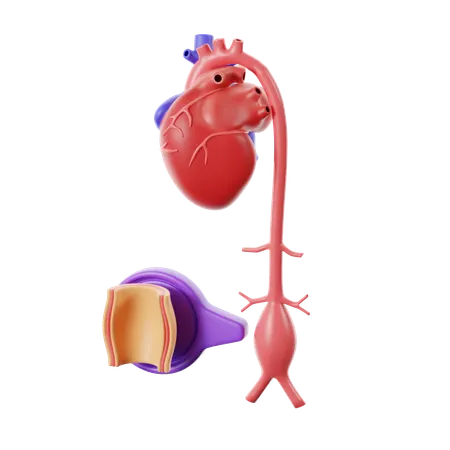 Herzkrankheit Aneurysma  3D Icon