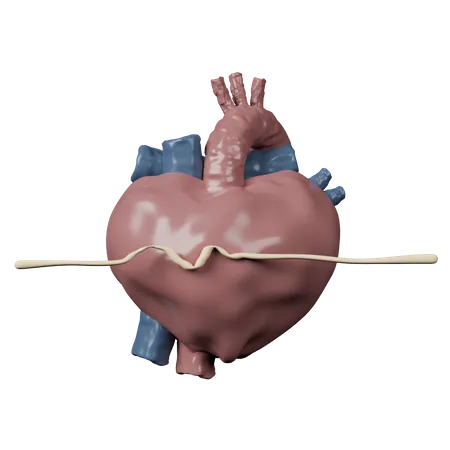 Herzstillstand  3D Icon