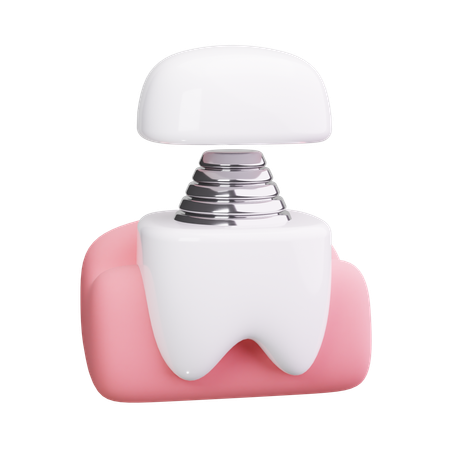 Implant  3D Icon