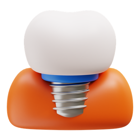 Implant dentaire  3D Icon