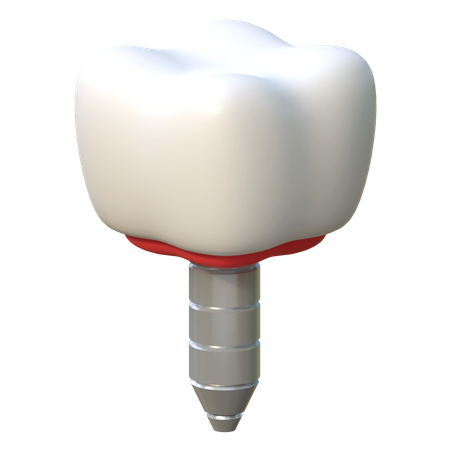 Implant dentaire  3D Icon