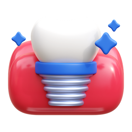 Implant dentaire  3D Icon