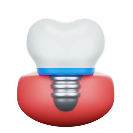 Implante dental  3D Icon