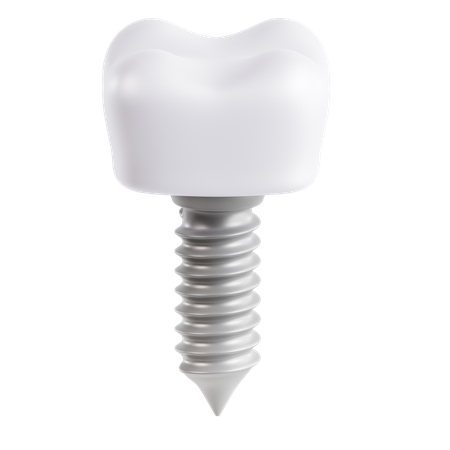 Implante dental  3D Icon