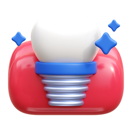 Implante dental  3D Icon