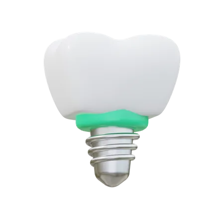 Implante dental  3D Icon