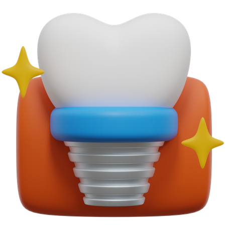 Implante dentário  3D Icon