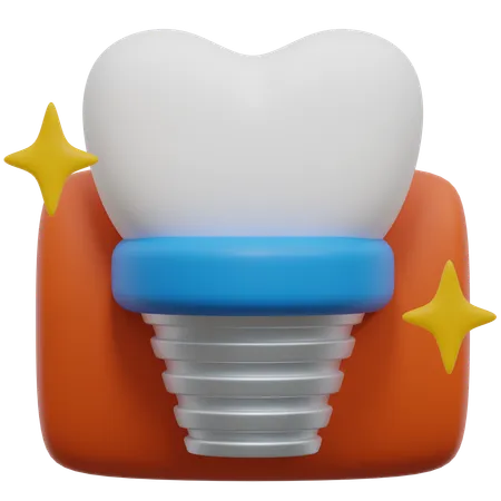 Implante dentário  3D Icon