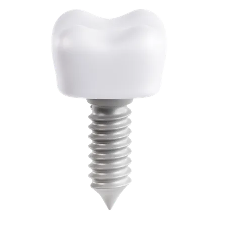 Implante dentário  3D Icon