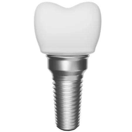 Implante dentário  3D Illustration