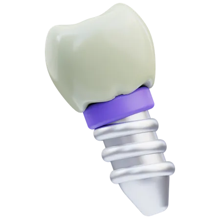 Implante dentário  3D Icon