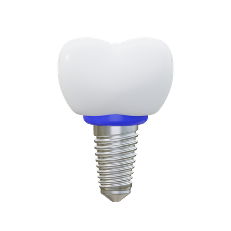 Implante dentário  3D Icon