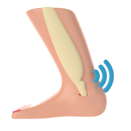 Infection in bone  3D Icon