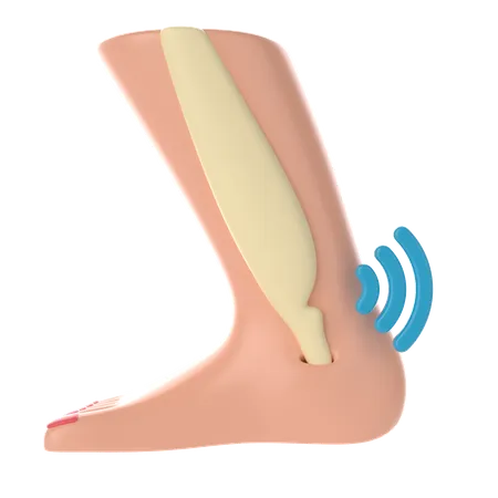 Infection in bone  3D Icon