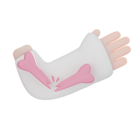 Injured Hand  3D Icon