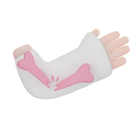 Injured Hand  3D Icon