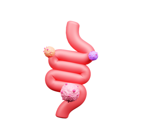 Intestine Cancer  3D Icon