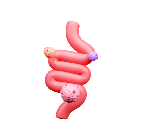 Intestine Cancer  3D Icon