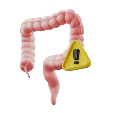 Irritable bowel  3D Icon