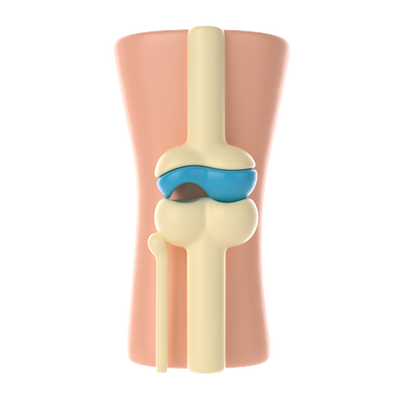 관절 손상 뼈  3D Icon