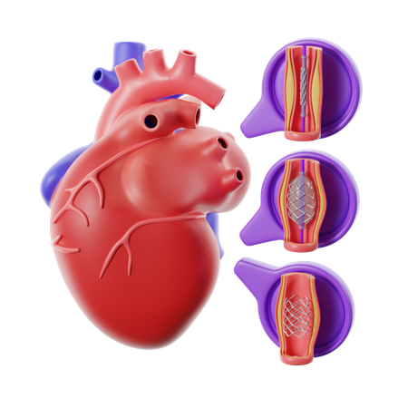 Katheterisierung Herzkrankheit  3D Icon