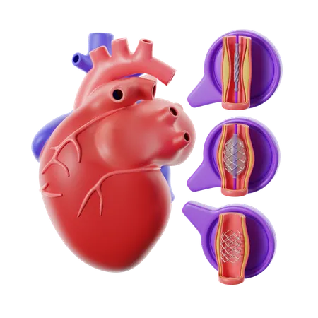 Katheterisierung Herzkrankheit  3D Icon