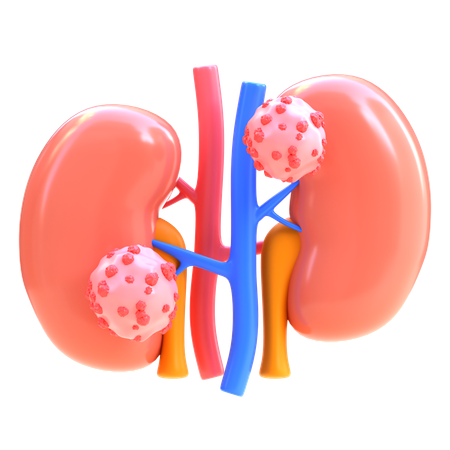 Kidney Cancer  3D Icon