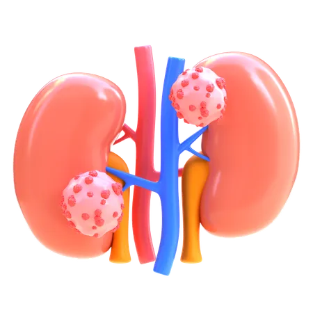 Kidney Cancer  3D Icon