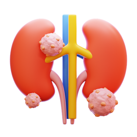 Kidney Cancer  3D Icon