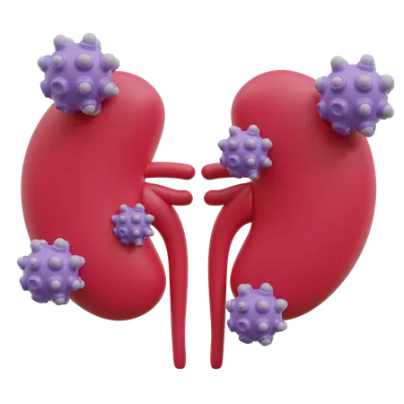 Kidney Cancer  3D Icon