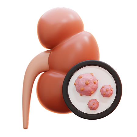 Kidney cancer  3D Icon