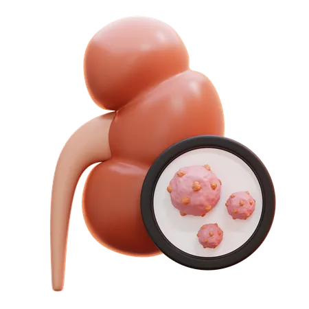 Kidney cancer  3D Icon