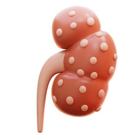 Kidney failure  3D Icon